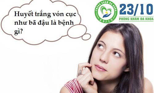 Huyết trắng vón cục như bã đậu có nguy hiểm không?