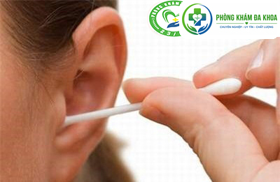 Lấy ráy tai không an toàn là nguyên nhân dẫn đến viêm tai giữa
