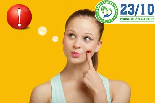Lưu ý trong hỗ trợ điều trị viêm lộ tuyến cổ tử cung