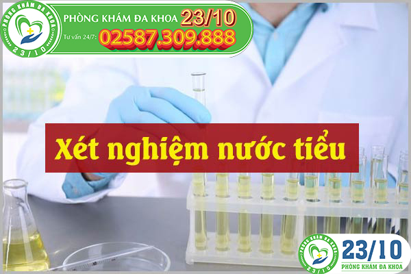 Xét nghiệm nước tiểu giúp phát hiện và chuẩn đoán bệnh sớm
