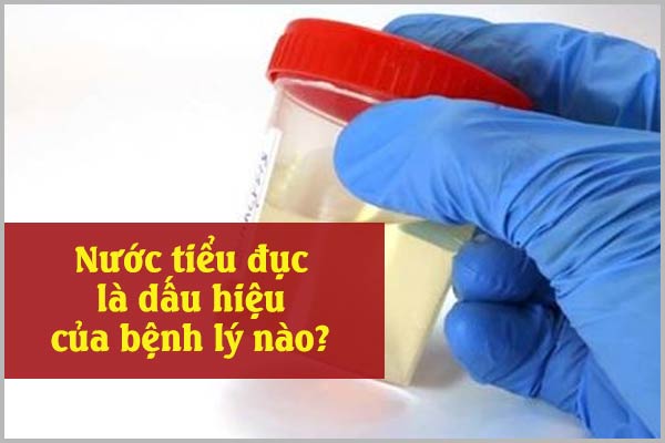 NƯỚC TIỂU ĐỤC LÀ DẤU HIỆU CỦA BỆNH LÝ NÀO?