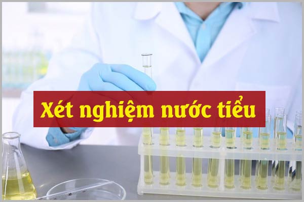 XÉT NGHIỆM NƯỚC TIỂU CHÍNH XÁC Ở ĐÂU ĐỂ CHUẨN ĐOÁN RA BỆNH?