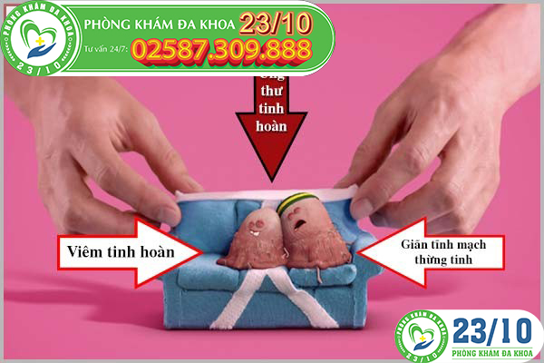 Nguyên nhân dẫn đến tình trạng tinh hoàn chảy xệ.