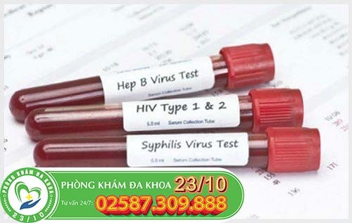 Các xét nghiệm cần phải kiểm tra trước khi kết hôn