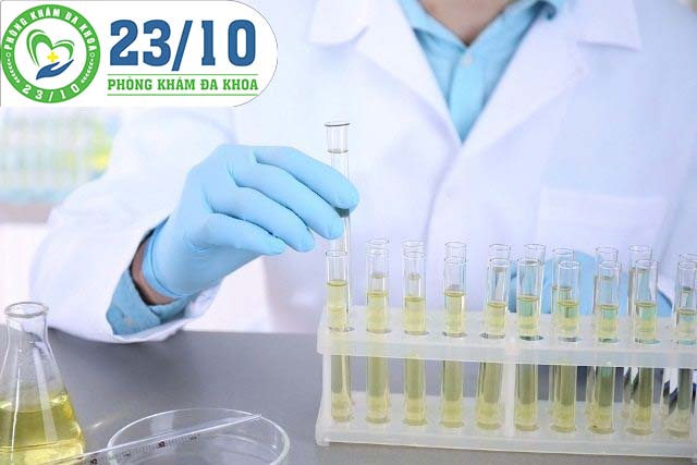Phương pháp xét nghiệm chlamydia