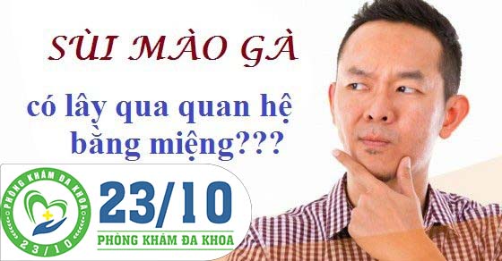 SÙI MÀO GÀ CÓ LÂY QUA ĐƯỜNG QUAN HỆ BẰNG MIỆNG KHÔNG?