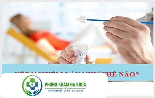 Xét nghiệm bệnh lậu bằng phương pháp nào?