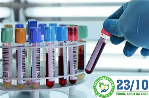 Xét nghiệm HSV mụn rộp sinh dục như thế nào và ở đâu?
