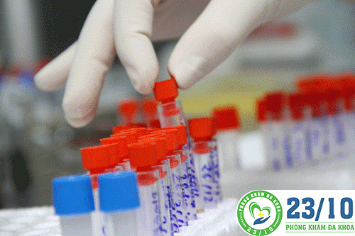 Phương pháp xét nghiệm chlamydia