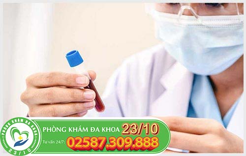 Tinh hoàn có thể được kiểm tra, thăm khám và xét nghiệm bằng nhiều cách khác nhau Tinh hoàn có thể được kiểm tra, thăm khám và xét nghiệm bằng nhiều cách khác nhau