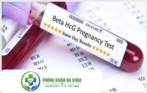 Xét nghiệm máu giúp nhận biết mang thai từ sớm
