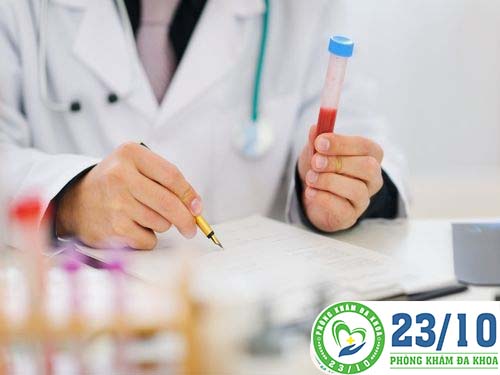 Xét nghiệm HSV mụn rộp sinh dục